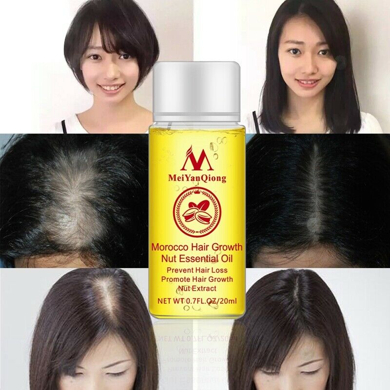 MeiYanQiong Morocco Nuts Hair Fast Powerful Growth Essence 3PCS Preventing  Q2Z9