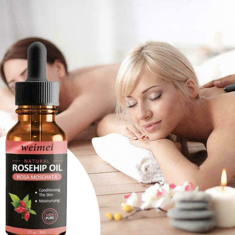 Skin Whitening Oil Brightening Dark Spot Removal 30ml Quality Essence Care V6S1