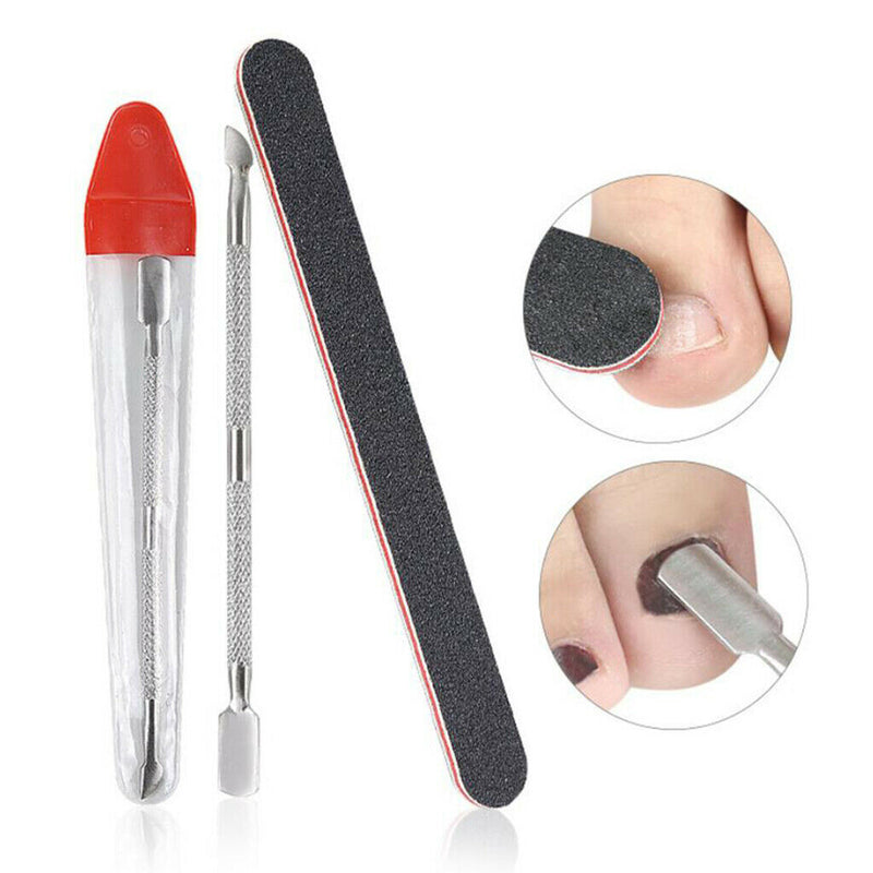 Ingrown Toenail Corrector Patch Brace Treatment Tape w/Pusher Nail File Set