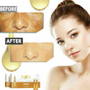 Whitening Spotless Ampoule Serum (Set of 7) - FREE Hot SHIPPING J1U5