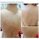 Skin Menu 100G Bamboo Charcoal Sea Salt Acne Treatments Handmade Soap Oil C