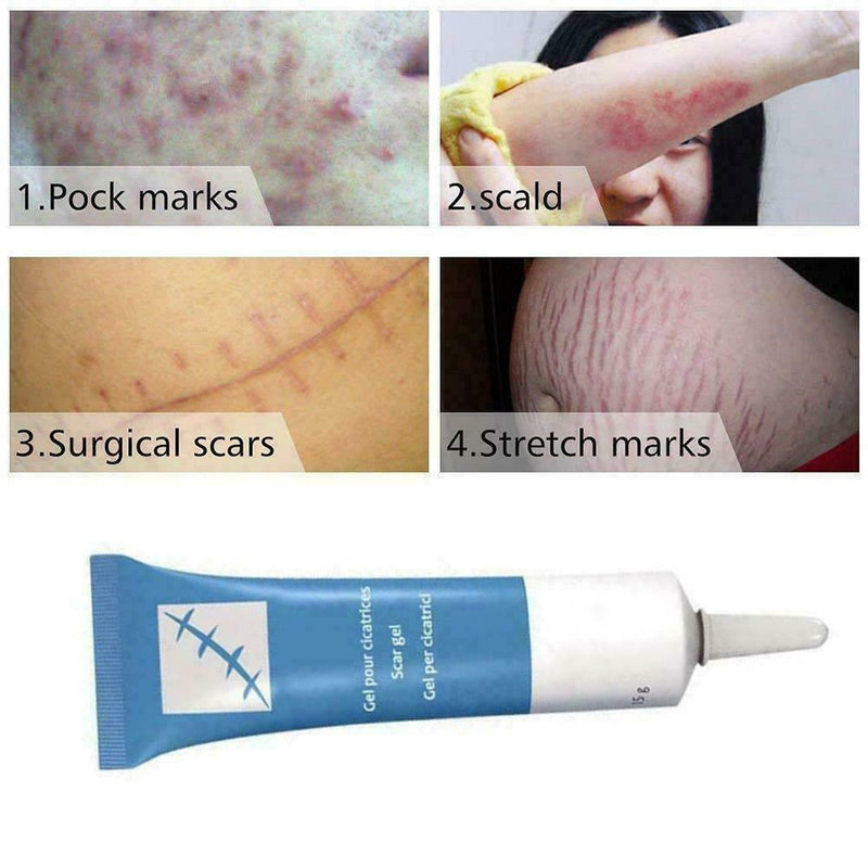 Universal Silicone Scar Remover Removal Serum Face Skin Burns Repair U2R1