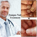 10ml Nail Repair Treatment Liquid Cleanser Onychomycosis Disinfect Water ne U6U7