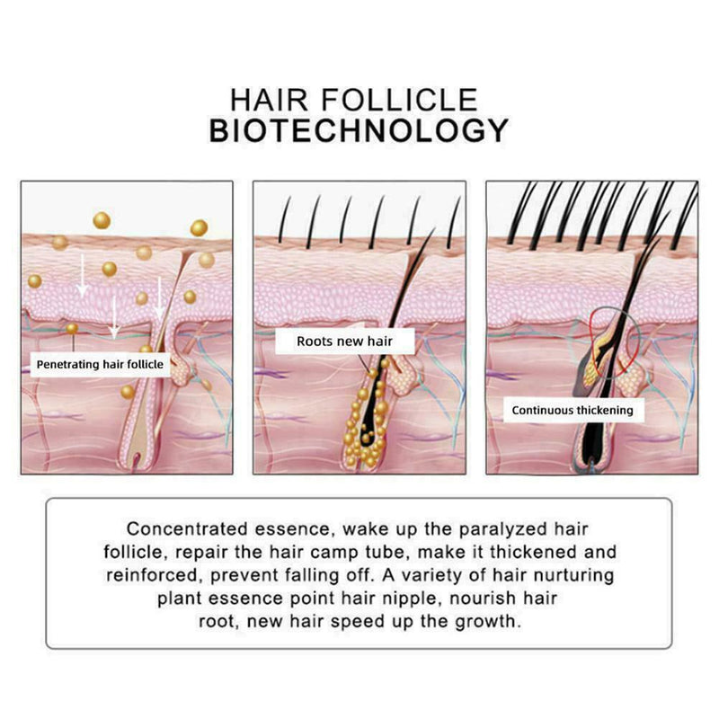 Hair Revitalizing Serum Ginger Fast Growth Essential Preventing Anti Oil Q4D7