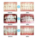 Dental orthodontic brackets Metal brackets Square brackets Supply I2Q1 I7C9 G0P6