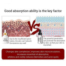 Rosehip Oil Moisturizing Essential Oil Rose Hip Skin Scars Acne Care Serum G1A2