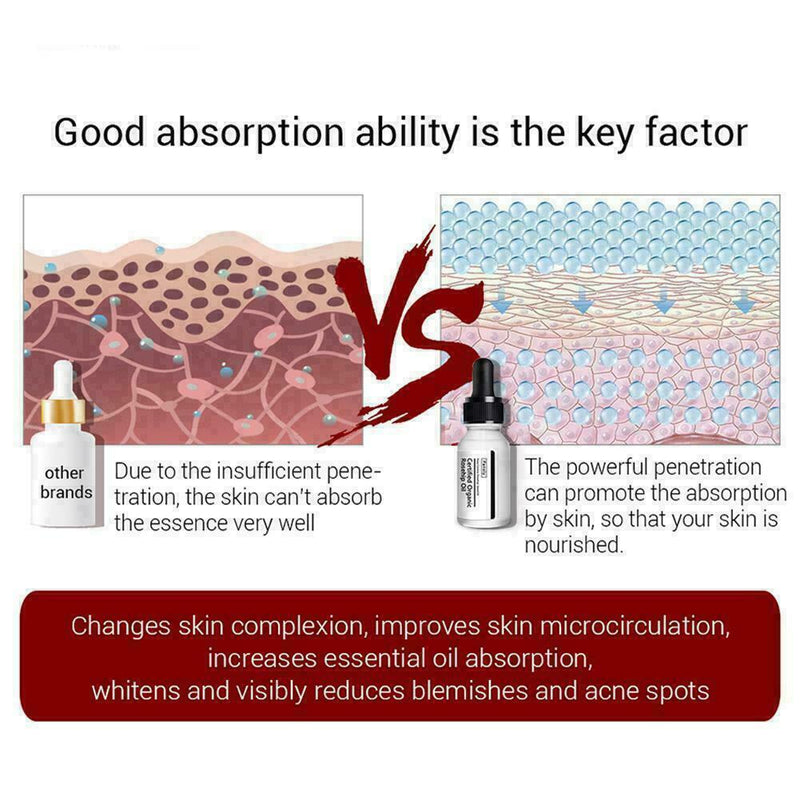 Rosehip Oil Moisturizing Essential Oil Rose Hip Skin Scars Acne Care Serum G1A2