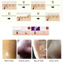 Vacuum Blackhead Remover Face Acne Pimple Removal Suction Clean Tool (White