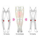 3Pcs/Set New Posture Available All Day O/X Type Leg Bowed Legs Knee Valgum  B4N8