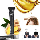 20ml Scalp Intens Roll-on Hair Growth Serum Hair Growth Hair Loss Essence