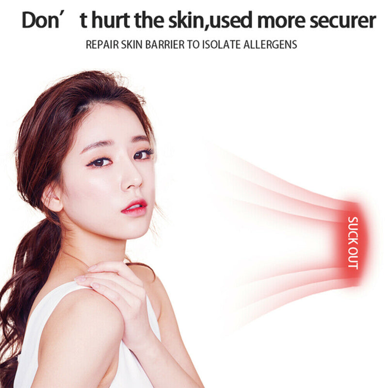 Electric Facial Blackhead Remover Vacuum Suction Skin Nose Pore Cleaner