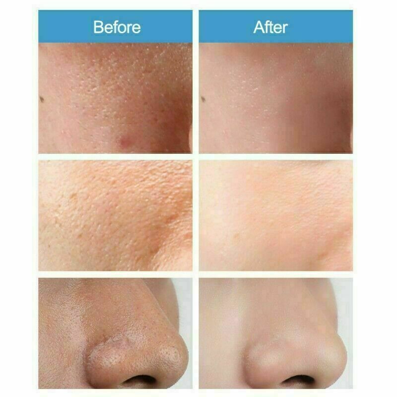 Pore Shrinking Liquid Moisturizing Control Oil Firming Essence Pores Shrink B2V9