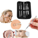 Professional Black head Remover Tool Kit Stainless Steel Blackhead Acne Com