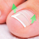 Ingrown Toenail Pedicure Tool Straightening Clip Curved Brace for Toenails Foot