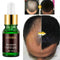 2019 Ginger Germinal Hair Growth Serum Hairdressing Oil Loss Treatement A9H D0S3