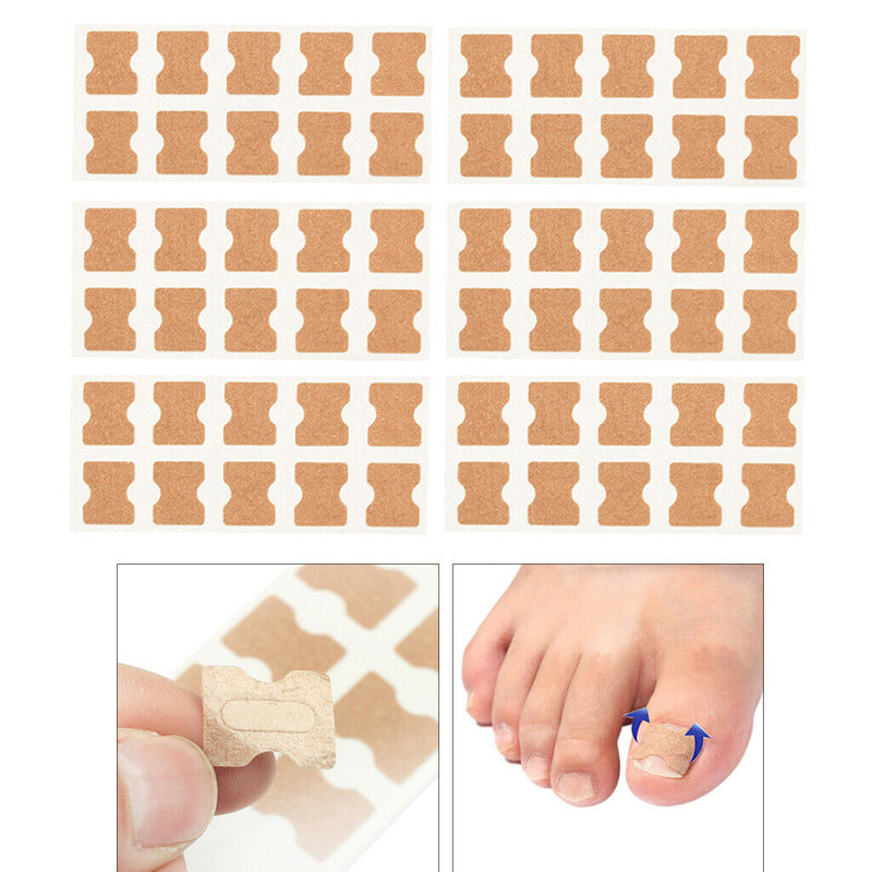 60Pcs Toenail Corrector Stickers Toe Nail Fixer Toe Nail Care Correction