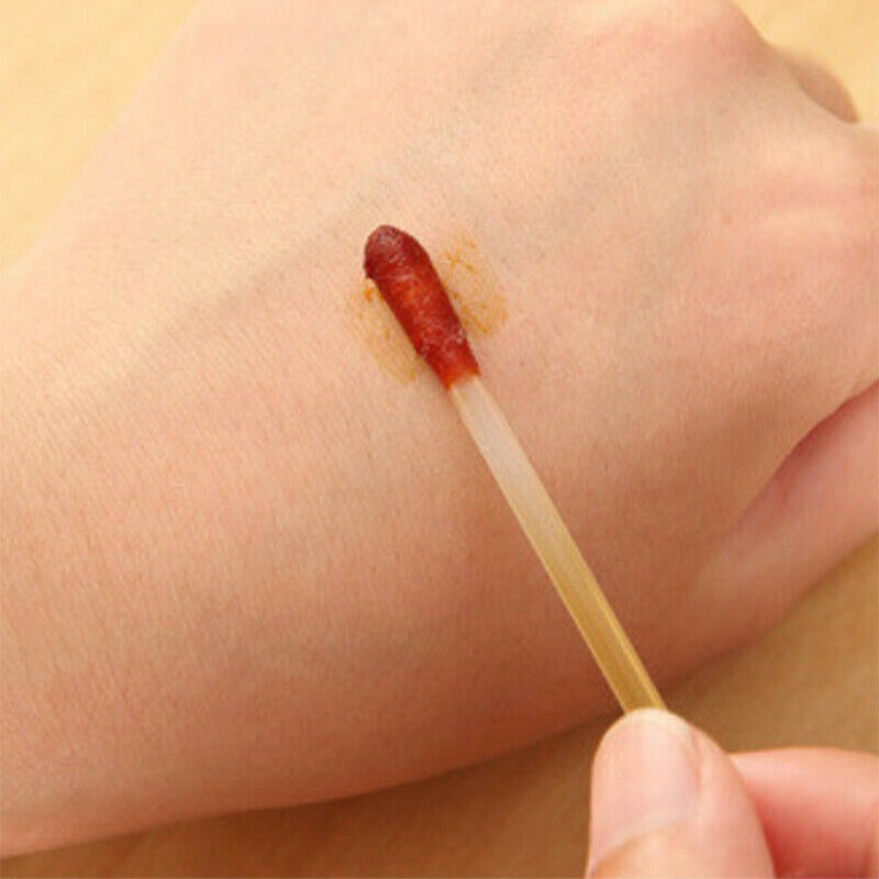 Disposable 100pcs Medical Iodine Cotton Stick Bar Iodine Disinfected Cotton au