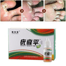 Chinese Medicine Treatment Foot Corn Removal Plantar Foot Car R8M9 warts Ve R8E9