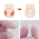 10Pcs / Lot 4Mm Embedded Toenail Correction Stickers Can Be Straightened Na