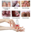 Nail Treatment Essential Oil Nail Nourishing Brightening Promote Nails Foot Y2J3