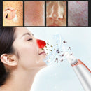 Fully Electric Electric Blackhead Remover Vacuum Pore Cleaner Facial Exfoli A2P2