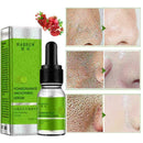 10ml Face Essence Care Hyaluronic Whitening Shrink Pores X4C2 K7R9 D8L6 O2V1