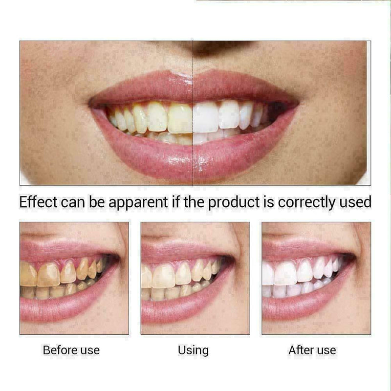Teeth Whitening Cleaning Teeth Remove Stains/Coffee Stains W6V5 D2X0 Favor H5M2
