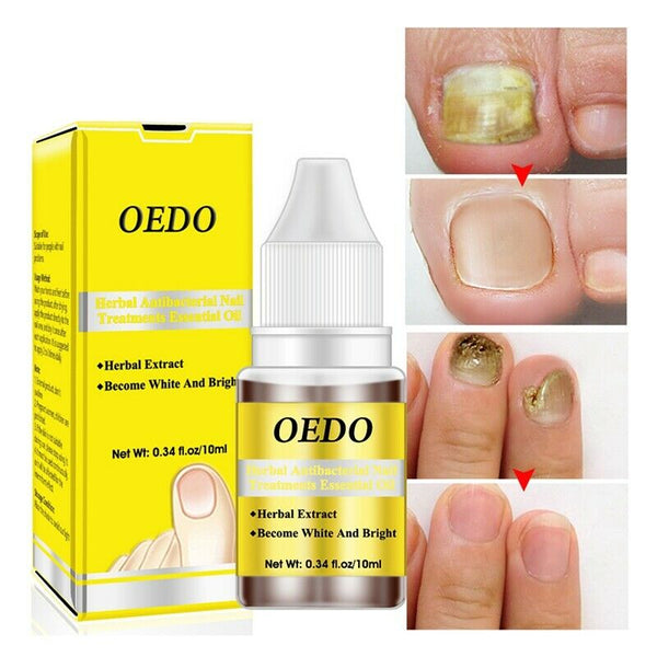 Oedo herbal Antibacterial Nail Treatments Essential Oil Herbal Extract Nail A4R7