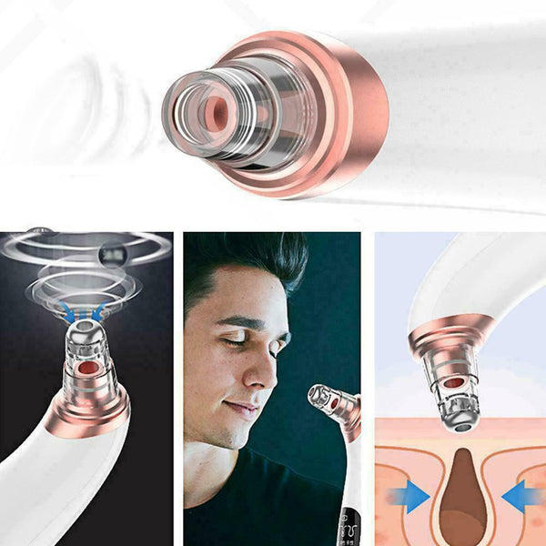 Electric Facial Skin Care Pore Blackhead Remover Cleaner Acne 6 Vacuum Suck Y9I9