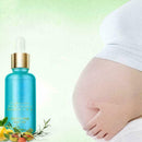 Best Essential oils For Stretch Marks remover strong Rem Y0T6 Marks30ml Str R2A8