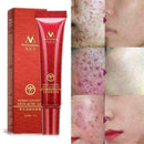 15ml Crema Acne para ELIMINA Barros Manchas Espinillas RECUP Tu I8P7 Piel L X4L1