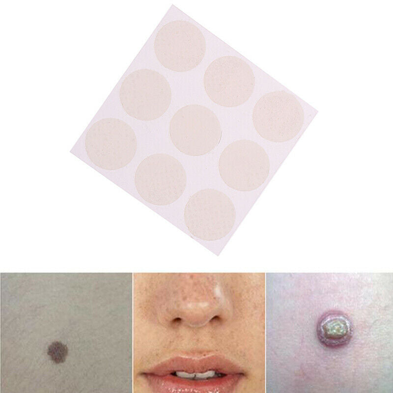 Skin Acne print Scar Away Patch Silicone Gel Sheet Wound Marks Treatment Remo 3C