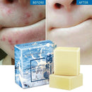 Sea Salt Soap Removal Pimple Pore Acne Treatment Goat Milk Soap Hn