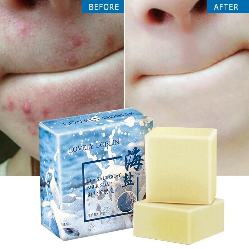 Sea Salt Soap Removal Pimple Pore Acne Treatment Goat Milk Soap Hn