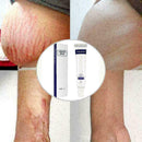 Entfernung Akne Narbe Stretch Marks Creme Fett Narbe Beha Striae Gravidarum Q2M9