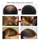 For Herbal Ginseng Raise Hair Growth Essence Hair Loss Treatment V2L8 U2E6 K6Y4