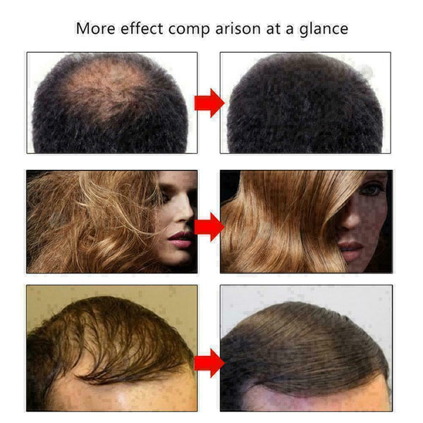 For Herbal Ginseng Raise Hair Growth Essence Hair Loss Treatment V2L8 U2E6 K6Y4