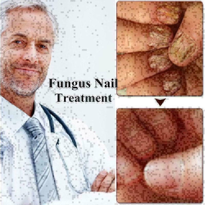 10ml Nail Repair Treatment Liquid Cleanser Onychomycosis Disinfect Water ne U6U7