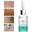 Ear Cleaner Antibacterial Solution For Pet Dog Cat Best Hot Fast  M E6O8