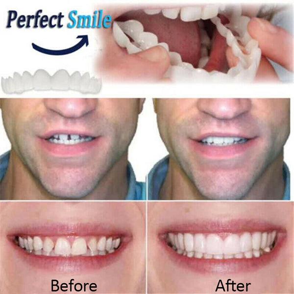 3X Cosmetic Dentistry Instant Perfect Smile Comfort Fit Flex Teeth VeneerJ %o