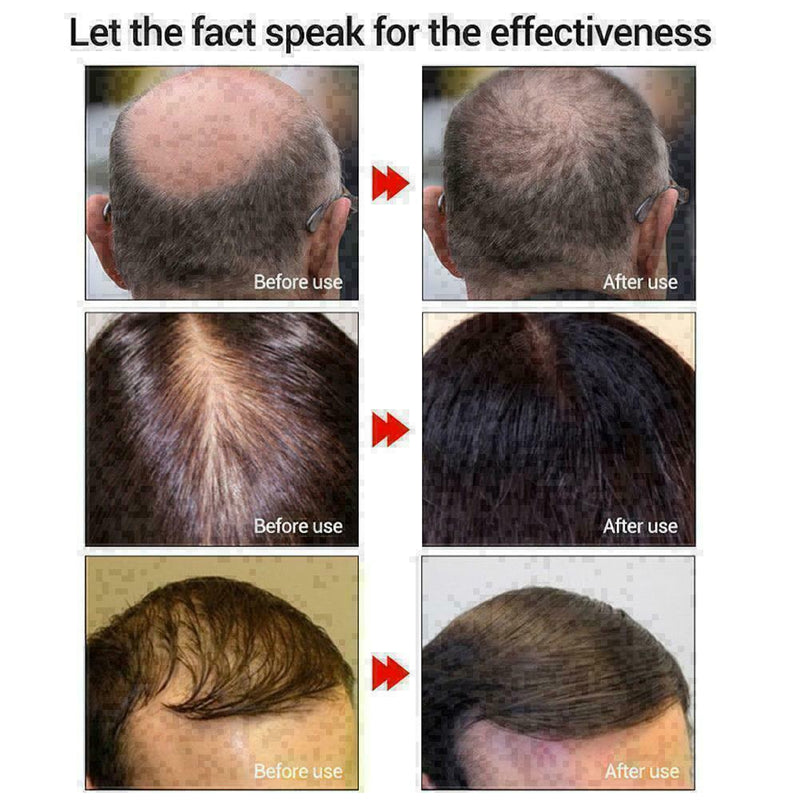 Hair Growth EssenceAndrea Liquid Oil Natural Organic Regrowth Treatment Sup T8Z6