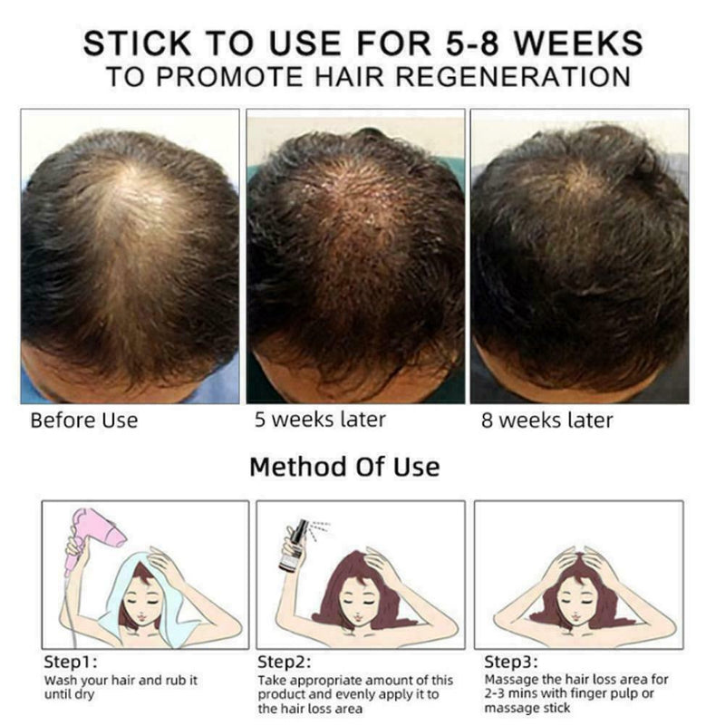 Hair Revitalizing Serum Ginger Fast Growth Essential Preventing Anti Oil Q4D7