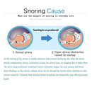 Stop Anti-Snoring Solution Tool Snore Stopper Mouthpiece Tray Sleeping 3pcs T3D4
