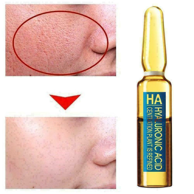Hyaluronic Acid Ampoule Face Serum Shrink Pores Anti-Ance Nicotinamide D8Q4 N0D5