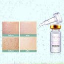 Cucnzn Hyaluronic Acid Liquid 10Ml Moisturizing Oil Lock The Bride Liquid A
