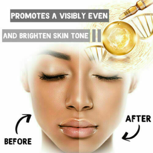 Whitening Spotless Ampoule Serum (Set of 7) - FREE Hot SHIPPING J1U5