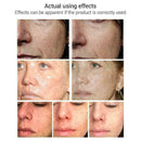 15ml Soins de la peau Blanchissant Huile Essentielle Vitamine S1Y0 SÃƒÂ©rum C W8Y2