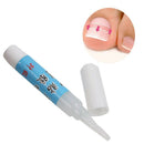 Nail Glue Ingrown Toenail Correction Pedicure Toe Patch Adhesive Foot Care  G1V3