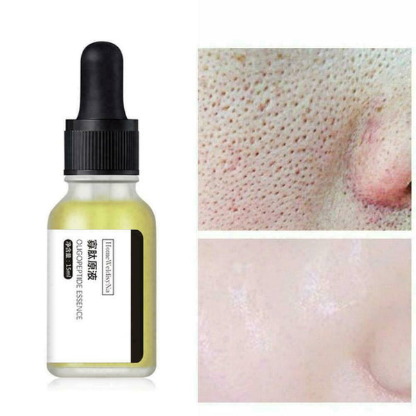 Oligopeptide stock solution acne to lighten acne marks repair red blood V5T9
