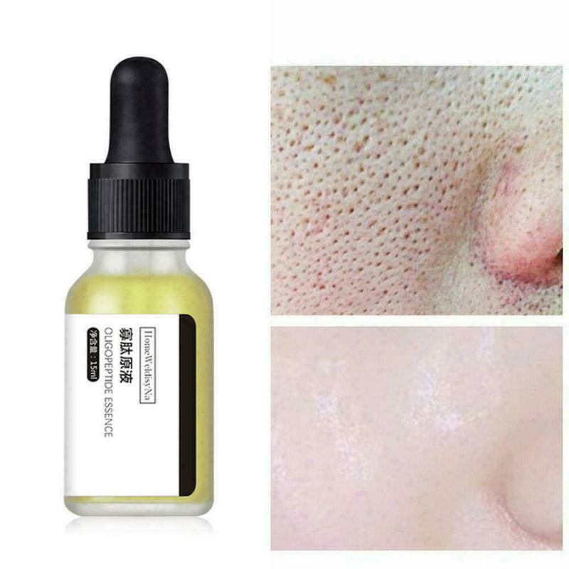 Oligopeptide stock solution acne to lighten acne marks repair red blood V5T9